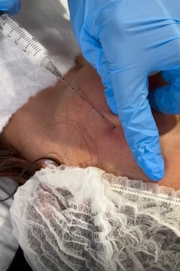 3a613281-9abb-4a08-a1ac-910381b60654