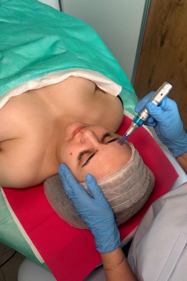 5db3ca4b-9329-442c-bffe-9cfece67556a