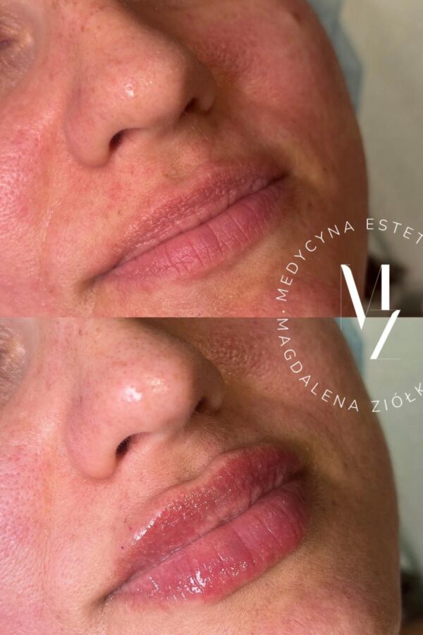 6034d345-a94c-4645-a7bd-8d4286a3ea37